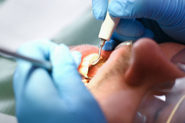 Best Emergency Denture Repair in Logan Elm Village, OH