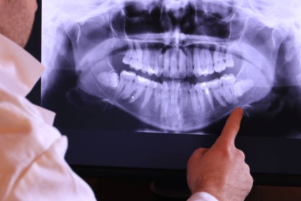 Best Emergency Root Canal Treatment in Logan Elm Village, OH