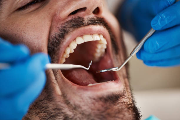 Best Emergency Dental Care for Broken or Chipped Teeth in Logan Elm Village, OH
